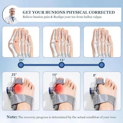FeetifFix™ Bunion Corrector – Relieve Pain & Realign Naturally