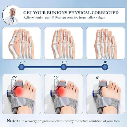FeetifFix™ Bunion Corrector – Relieve Pain & Realign Naturally